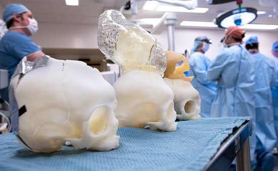 In 3D là gì? Ứng dụng của công nghệ in 3D 6 in-3D-la-gi